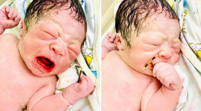 baby born holding IUD that failed to stop pregnancy